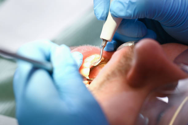 Best Broken or Chipped Tooth Repair in Townsend, DE